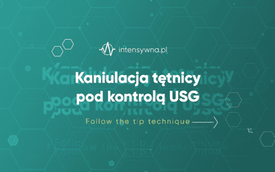 Kaniulacja tętnicy pod kontrolą USG